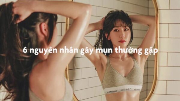 6 nguyên nhân gây mụn thường gặp